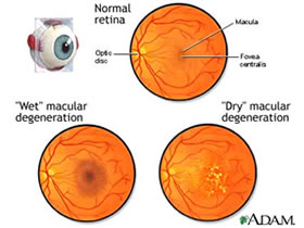 envejecimiento-retina