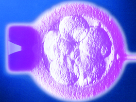 embrion