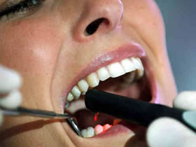 caries-dentista